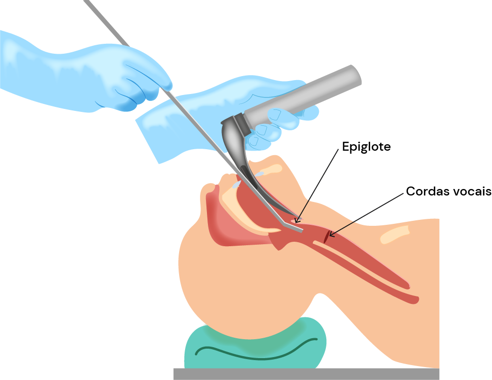 Texto alternativo para a imagem