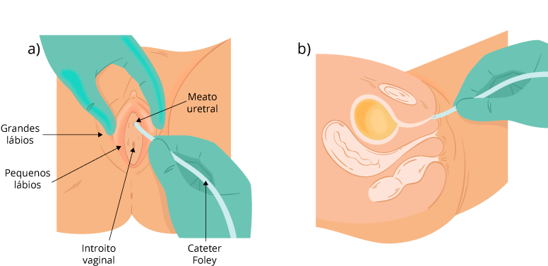 Texto alternativo para a imagem