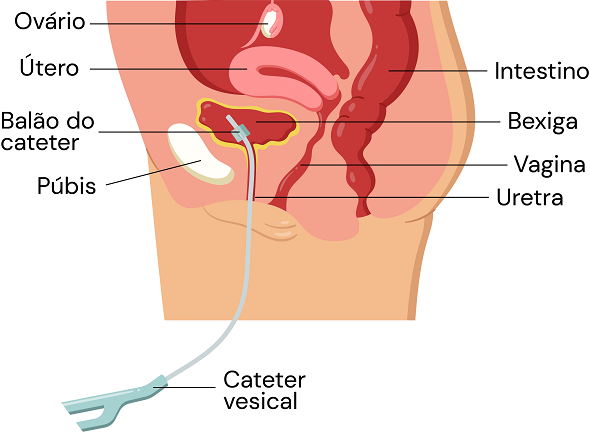 Texto alternativo para a imagem