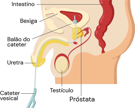 Texto alternativo para a imagem
