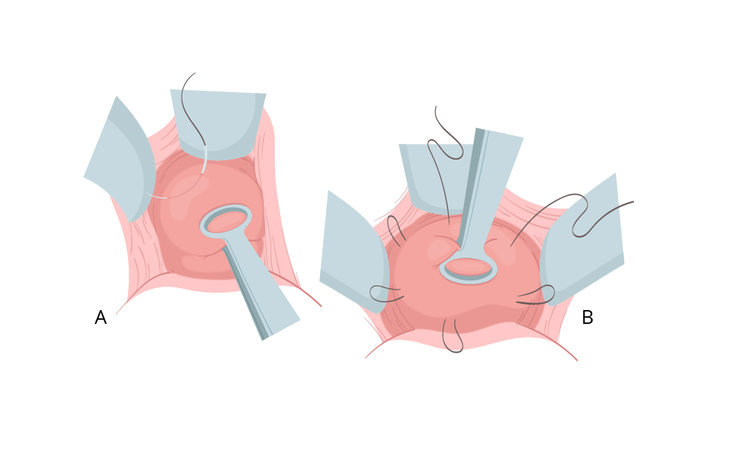 Texto alternativo para a imagem