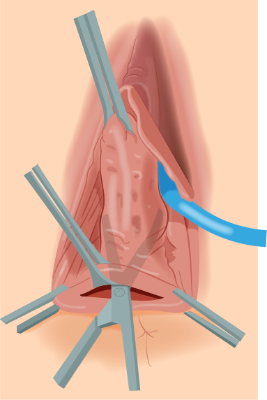 Texto alternativo para a imagem