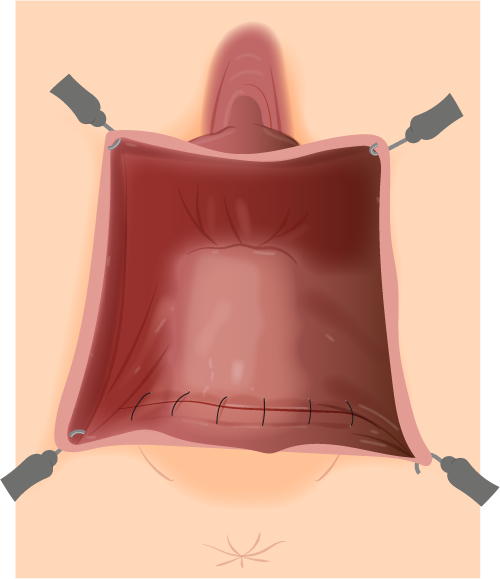 Texto alternativo para a imagem