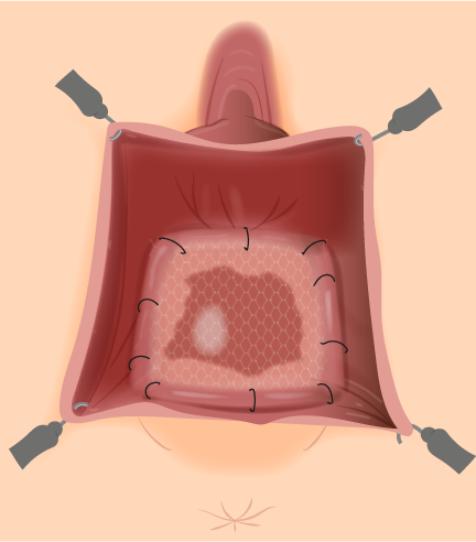 Texto alternativo para a imagem