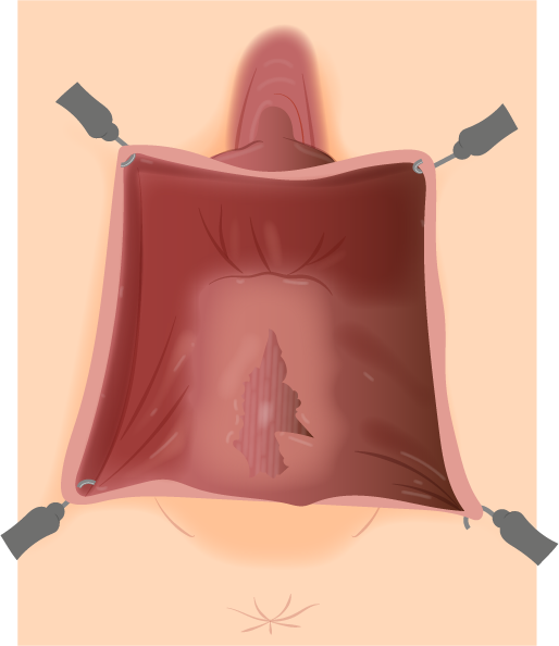 Texto alternativo para a imagem