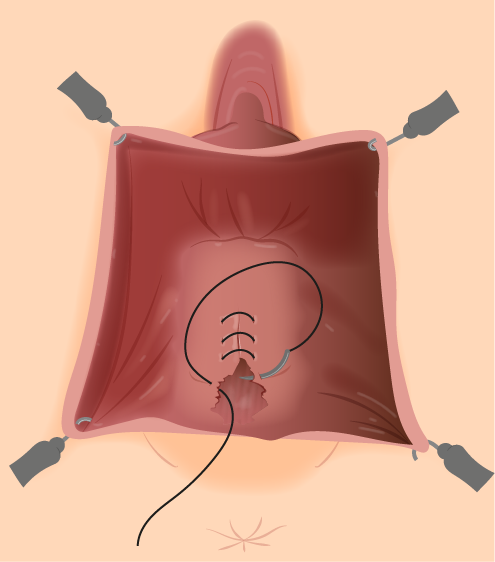 Texto alternativo para a imagem