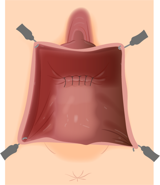 Texto alternativo para a imagem