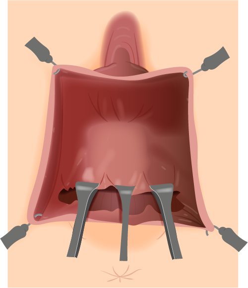 Texto alternativo para a imagem