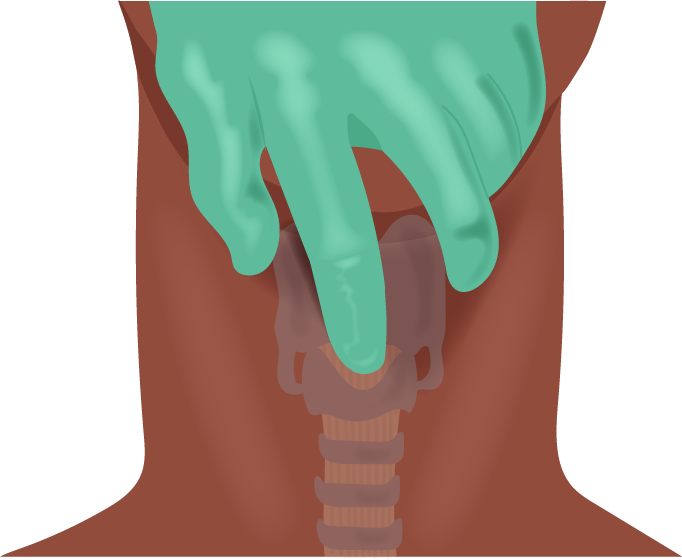 Texto alternativo para a imagem