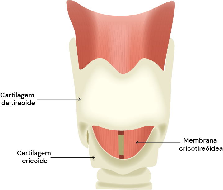 Texto alternativo para a imagem