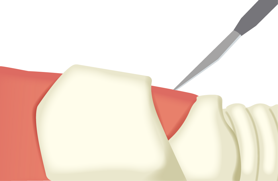 Texto alternativo para a imagem