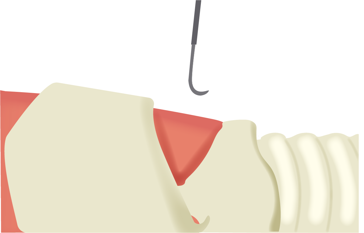 Texto alternativo para a imagem