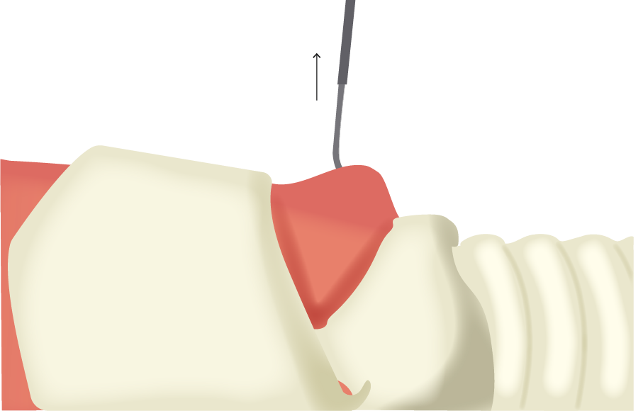 Texto alternativo para a imagem