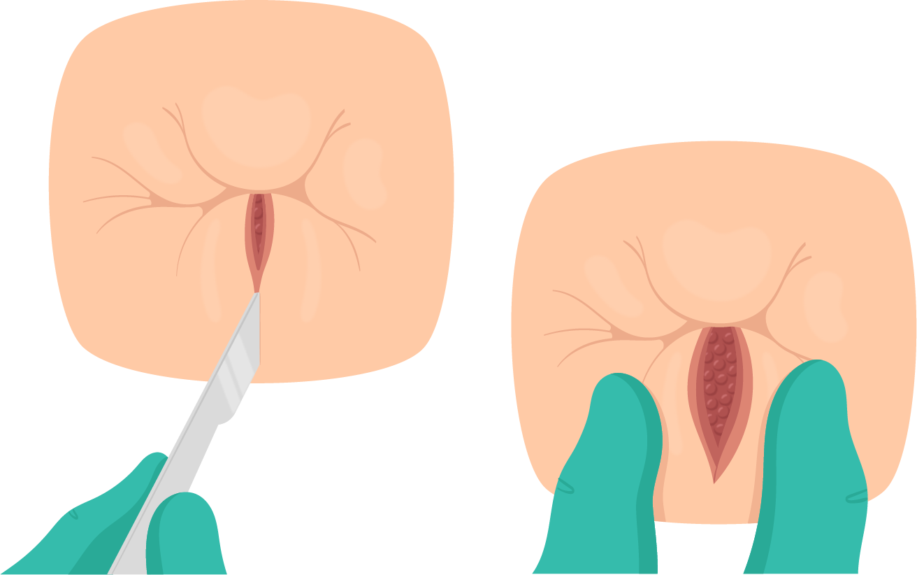 Texto alternativo para a imagem