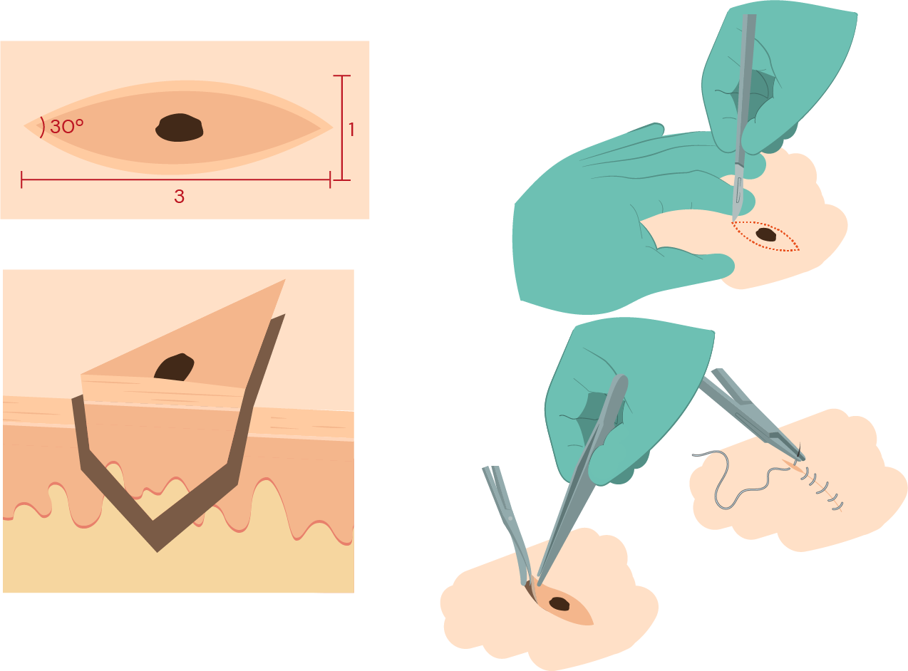 Texto alternativo para a imagem