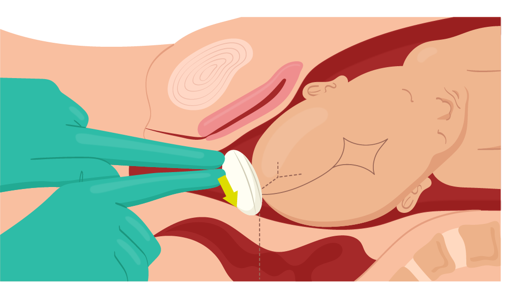 Texto alternativo para a imagem