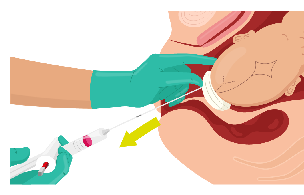 Texto alternativo para a imagem