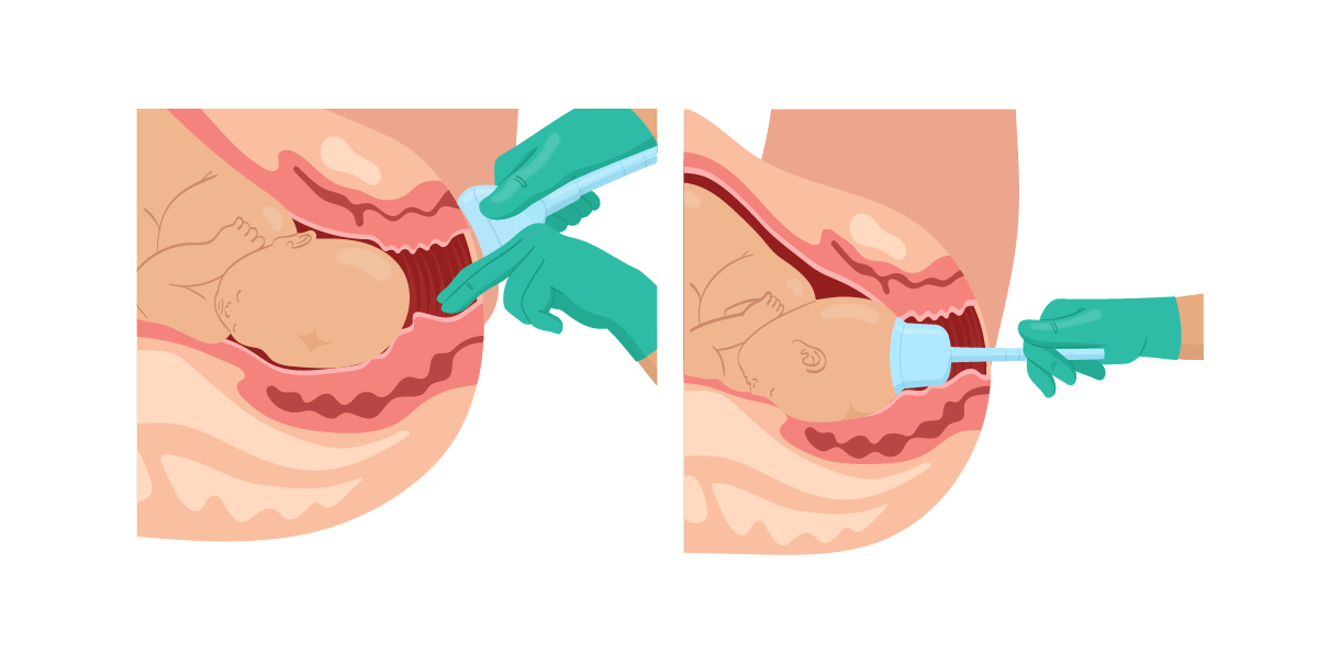 Texto alternativo para a imagem