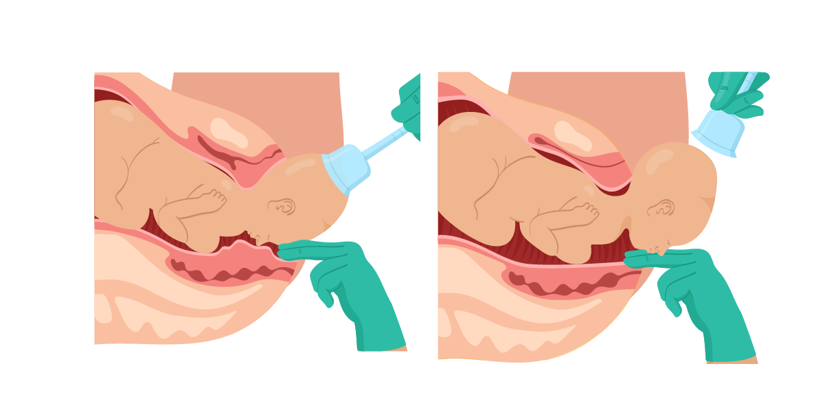 Texto alternativo para a imagem