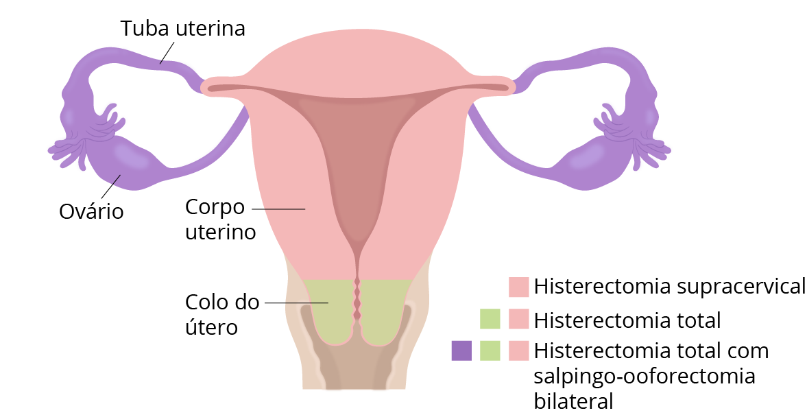 Texto alternativo para a imagem