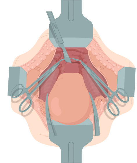 Texto alternativo para a imagem