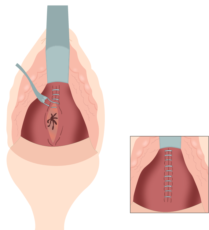 Texto alternativo para a imagem