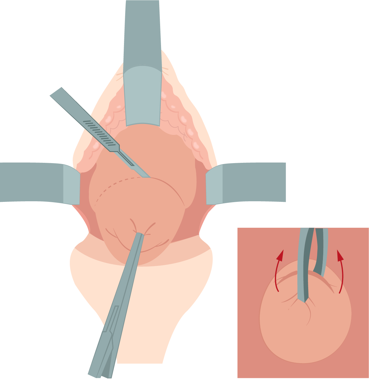 Texto alternativo para a imagem