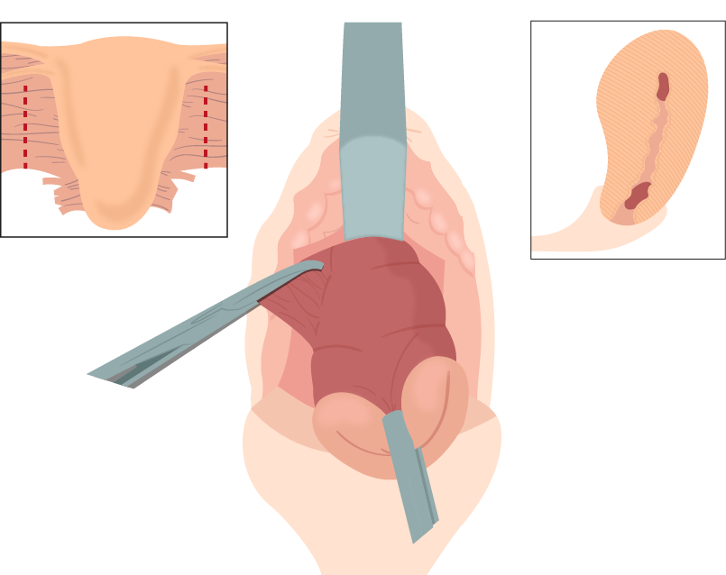 Texto alternativo para a imagem