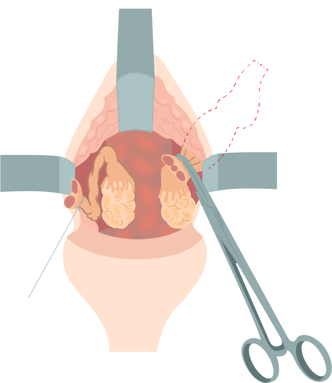 Texto alternativo para a imagem