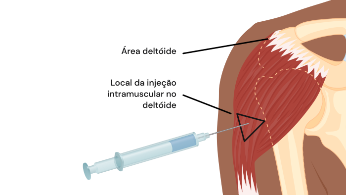 Texto alternativo para a imagem