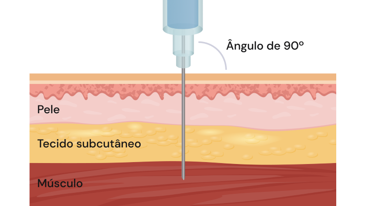 Texto alternativo para a imagem