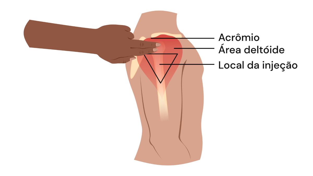 Texto alternativo para a imagem