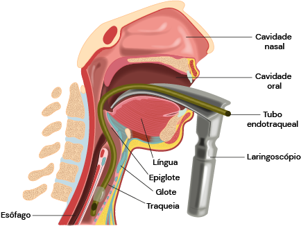 Texto alternativo para a imagem