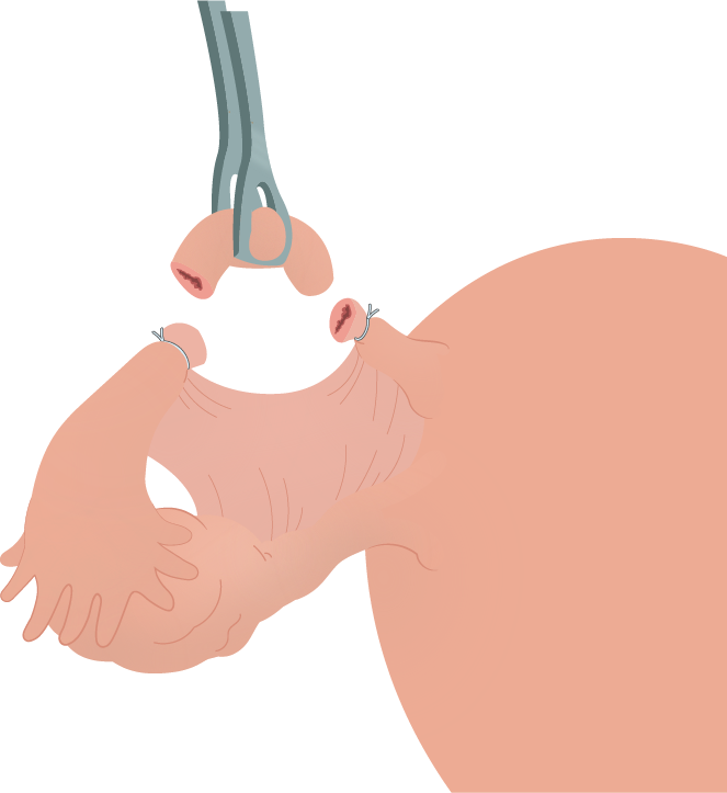 Texto alternativo para a imagem