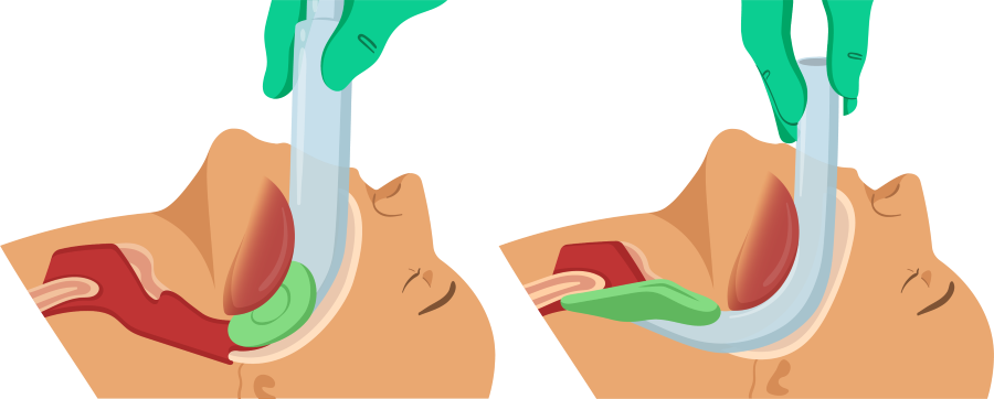 Texto alternativo para a imagem