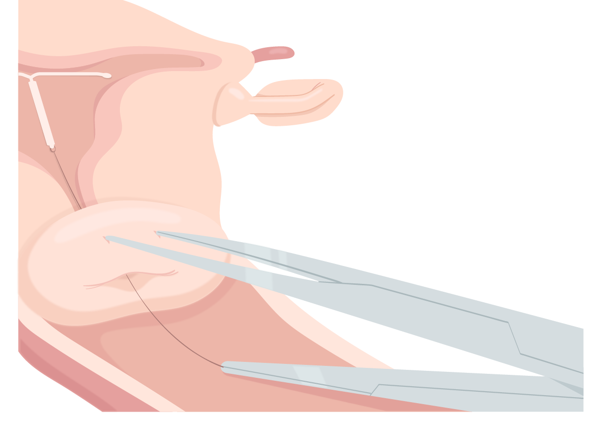 Texto alternativo para a imagem