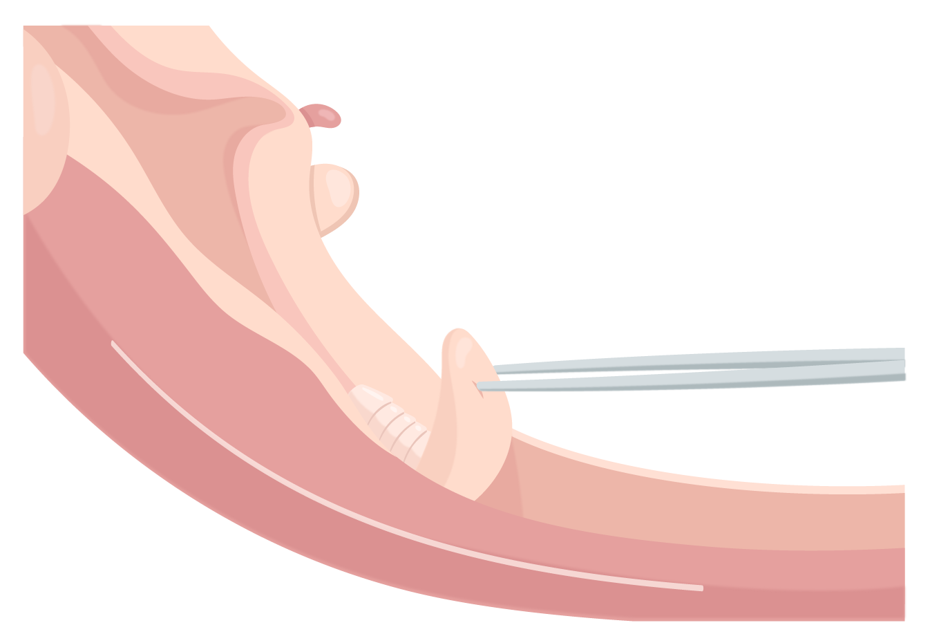 Texto alternativo para a imagem