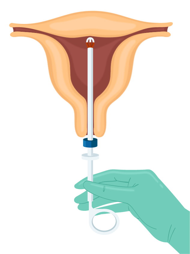 Texto alternativo para a imagem