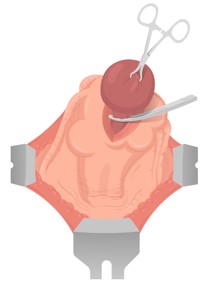 Texto alternativo para a imagem