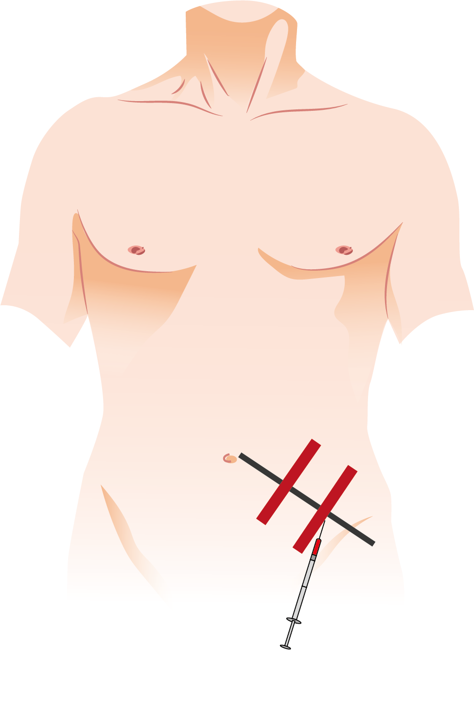 Texto alternativo para a imagem