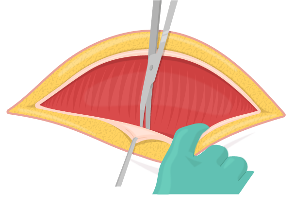 Texto alternativo para a imagem