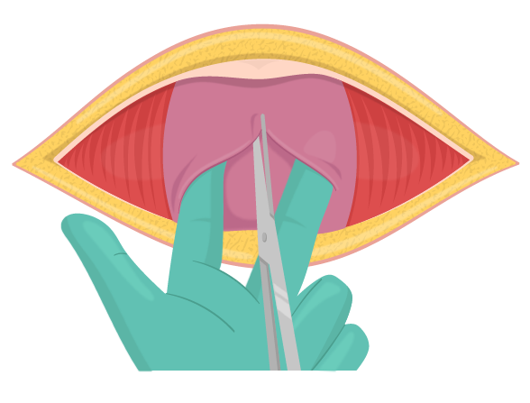 Texto alternativo para a imagem