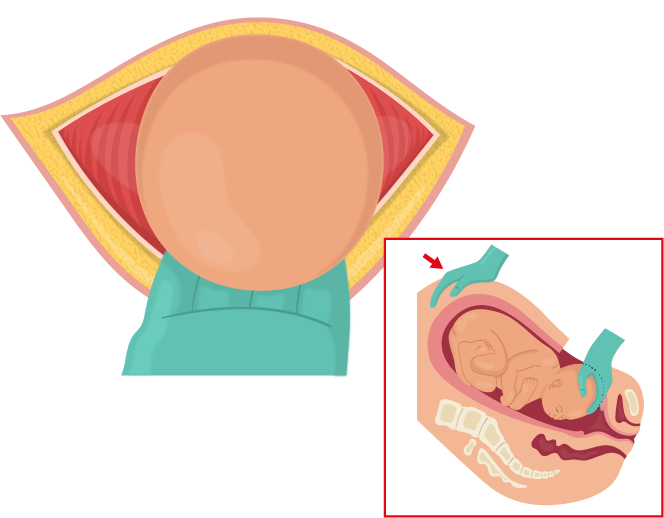 Texto alternativo para a imagem