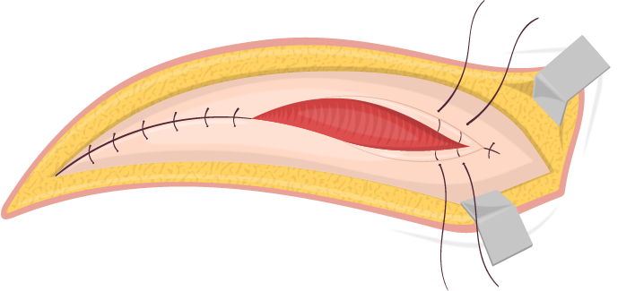 Texto alternativo para a imagem
