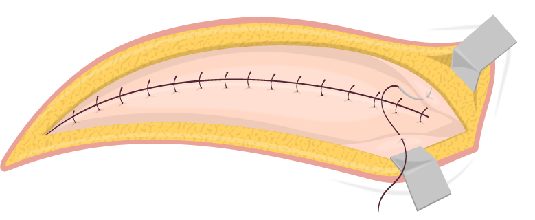 Texto alternativo para a imagem