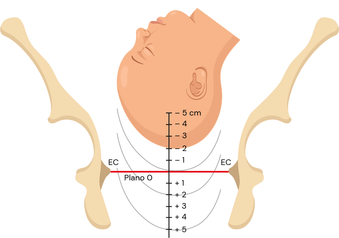 Texto alternativo para a imagem