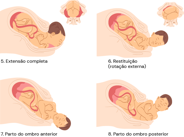 Texto alternativo para a imagem