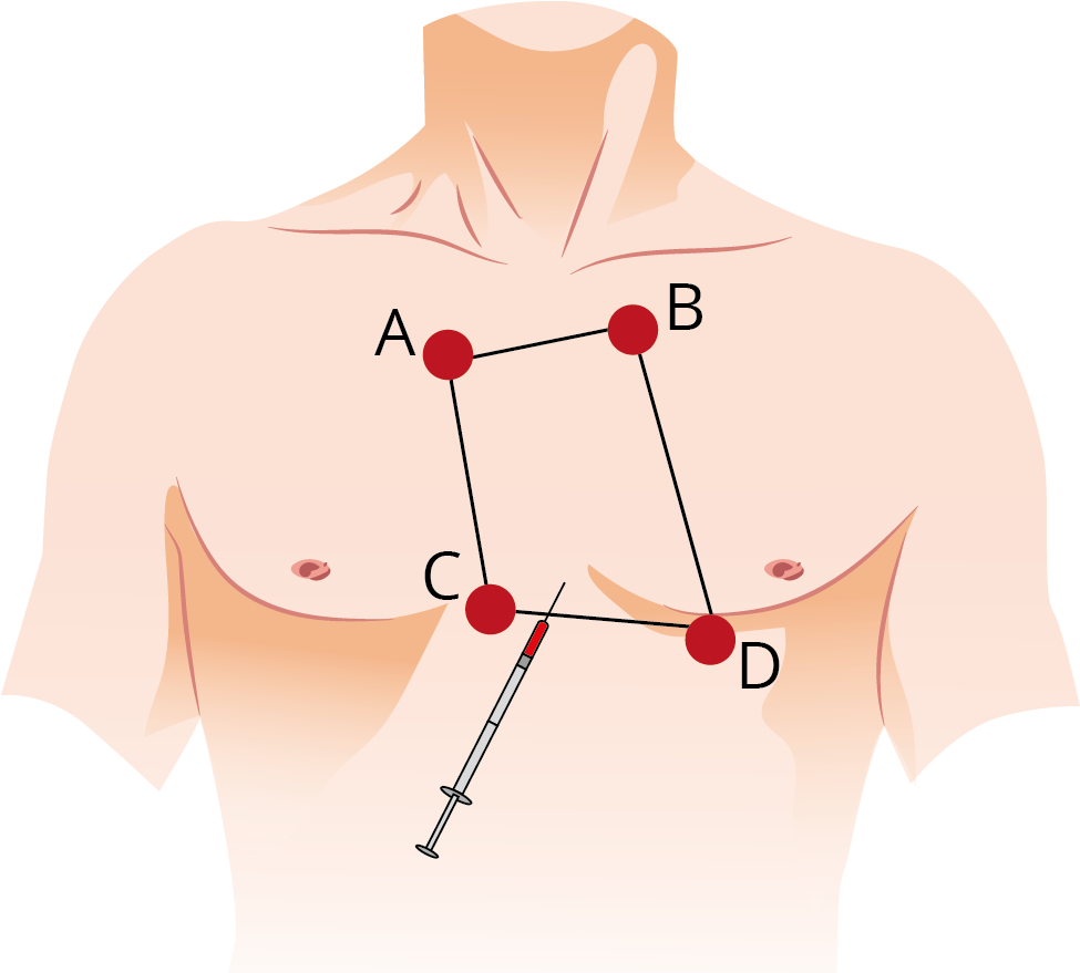 Texto alternativo para a imagem