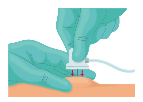 Texto alternativo para a imagem