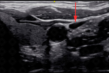 Texto alternativo para a imagem